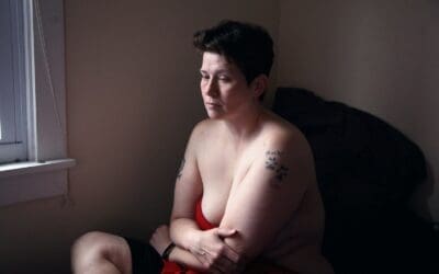 Are There Natural Ways to Manage PCOS?
